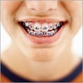 /album/orthodontics/orthodontis-1-jpg/